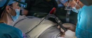 Clinica per trapianto di capelli Budapest, Ungheria